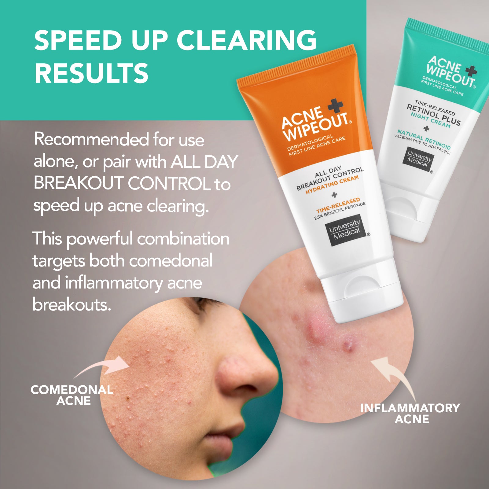 Acne Wipeout® Retinol Plus Night Cream